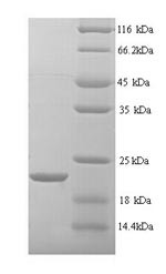 Matrilysin (Mmp7), rat, recombinant