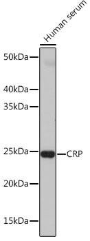 Anti-C-Reactive Protein (CRP)