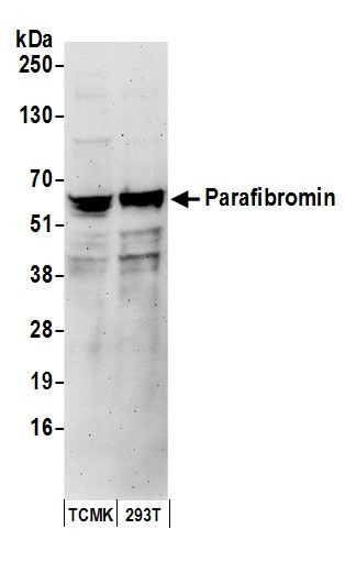 Anti-Parafibromin