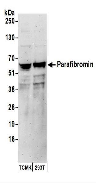 Anti-Parafibromin