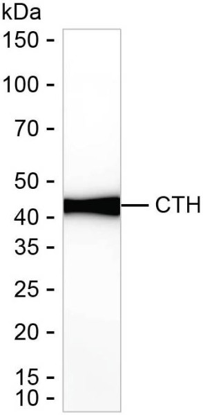 Anti-Cystathionase/CTH