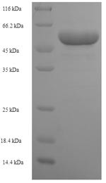 Ribose-phosphate pyrophosphokinase 1 (PRPS1), human, recombinant