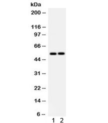 Anti-Srb1