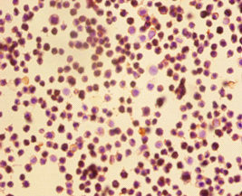 Anti-CDK4