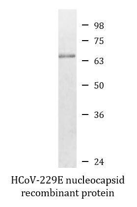 HCoV-229E nucleocapsid recombinant protein