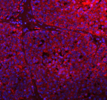 Anti-GCLC / Glutamate-cysteine ligase catalytic subunit