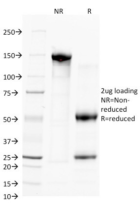 Anti-CD38 (ADP Ribosyl Cyclase 1), clone FS02