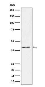 Anti-IL18BP / IL18 binding protein, clone 31I00