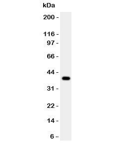 Anti-Cathepsin B
