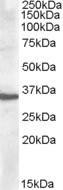 Anti-Apolipoprotein F, C-terminal