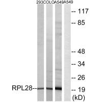 Anti-RPL28