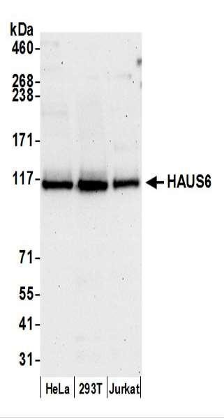 Anti-HAUS6