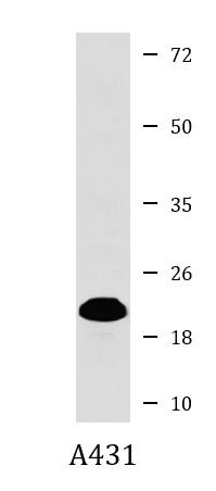 Anti-Proteasome 20S LMP2