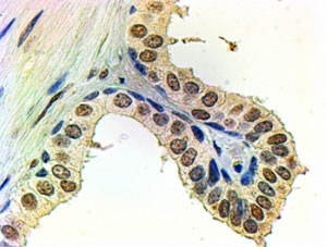 Anti-Androgen receptor