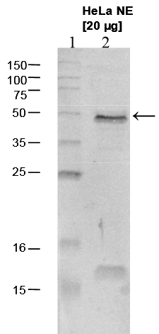 Anti-Set9
