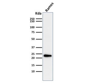 Anti-LMO2 / Rhombotin 2, clone LMO2/1971