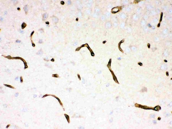 Anti-DMD / Dystrophin