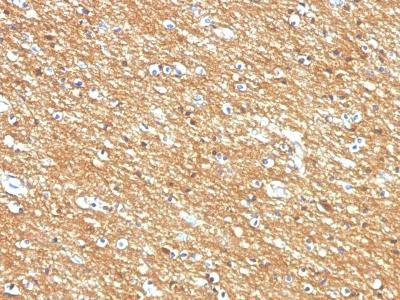 Anti-CD56 / NCAM1 / NKH1 (Neuronal Cell Marker)(Clone: 123A8, same 56C04)