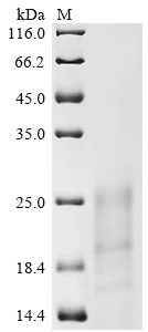 Protein OPG161 (OPG161), partial, Variola virus, recombinant