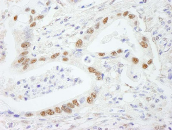 Anti-SF3b145/SAP145 (IHC)