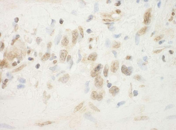 Anti-BHD (IHC)