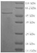 Complement C4-B (C4B), partial, human, recombinant