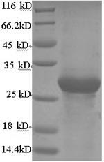 Adiponectin (ADIPOQ), bovine, recombinant