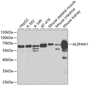 Anti-ALDH4A1