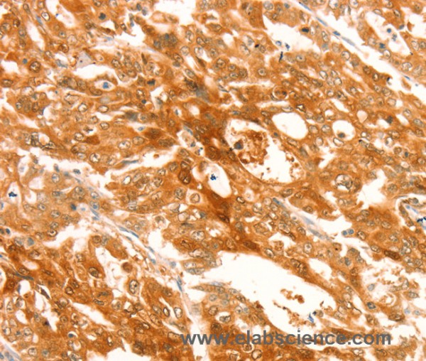 Anti-TRPM7