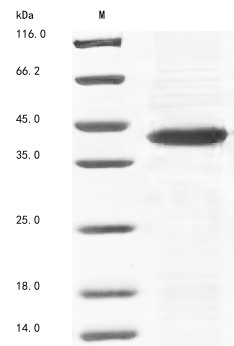 NADPH--cytochrome P450 reductase (Por), partial, mouse, recombinant