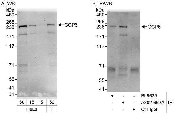 Anti-GCP6