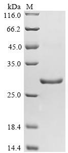 Glutathione S-transferase class-mu 26 kDa isozyme, Schistosoma japonicum, recombinant