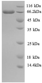 Long-chain-fatty-acid--CoA ligase (fadD), Escherichia coli, recombinant
