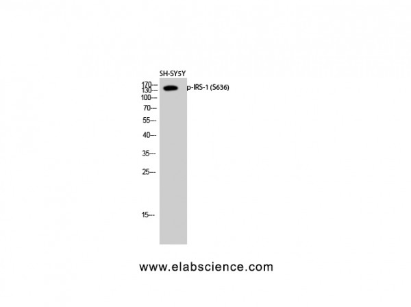 Anti-Phospho-IRS-1 (Ser636)