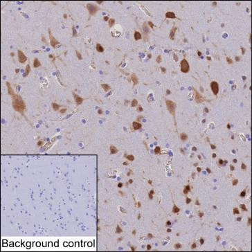 Anti-ELAVL2