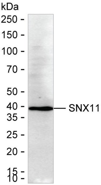 Anti-SNX11