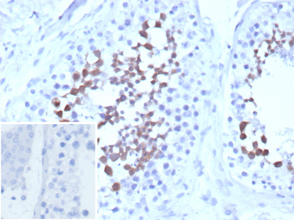 Anti-CETN1 / Centrin-1, clone CETN1/9878