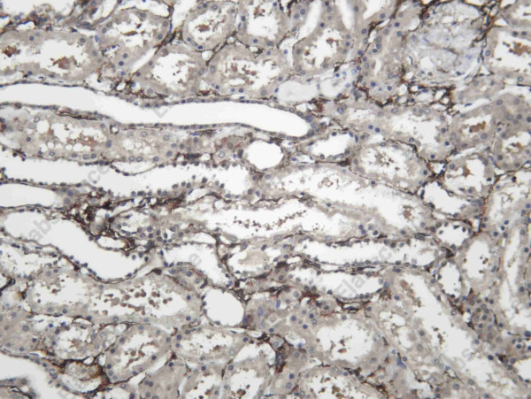 Anti-Recombinant S5A2, clone C112585