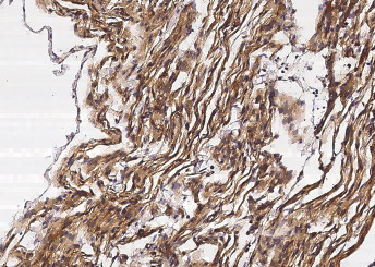 Anti-Neuropilin-1/NRP1/CD304 Monoclonal Recombinant Antibody