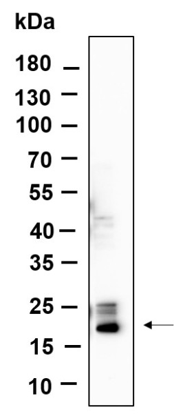 Anti-Recombinant Histone H3 (Tri Methyl Lys4), clone 1F10