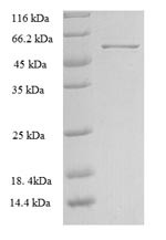 Rho guanine nucleotide exchange factor 7 (ARHGEF7), partial, human, recombinant
