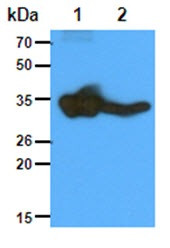 Anti-GNMT, clone 5D1