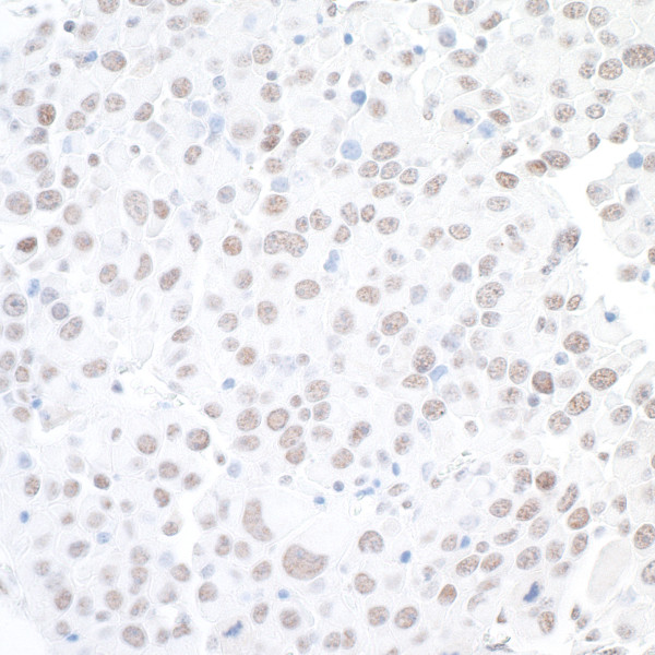 Anti-BAF53A