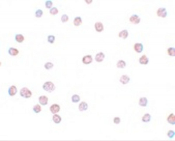 Anti-ATP11B