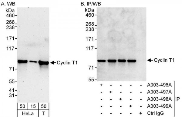 Anti-Cyclin T1