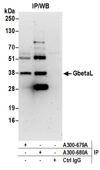Anti-GbetaL