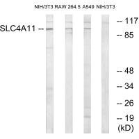 Anti-SLC4A11
