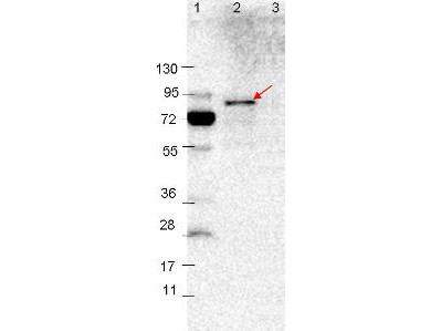 Anti-VlsE