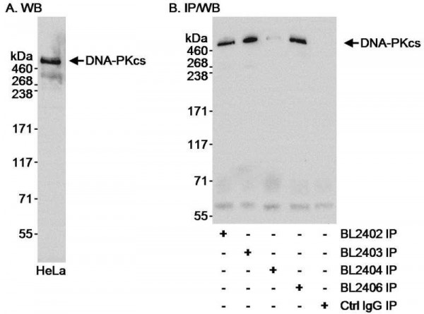 Anti-DNA-PKcs