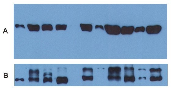 Anti-alpha Tubulin, clone TU-01